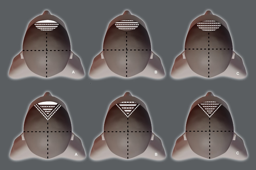 Money Piece – Το Φως του Προσώπου