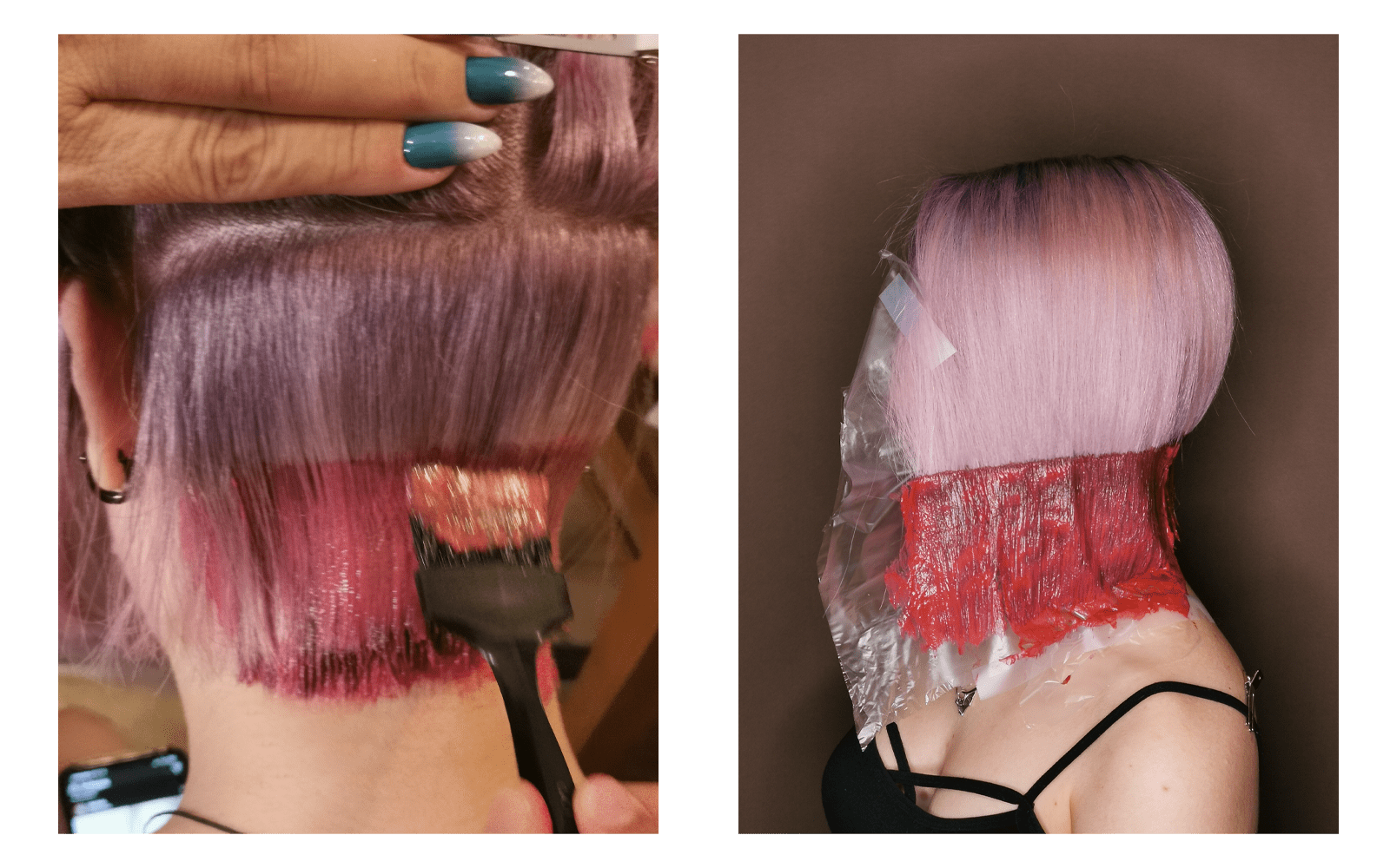 Shine Line technique