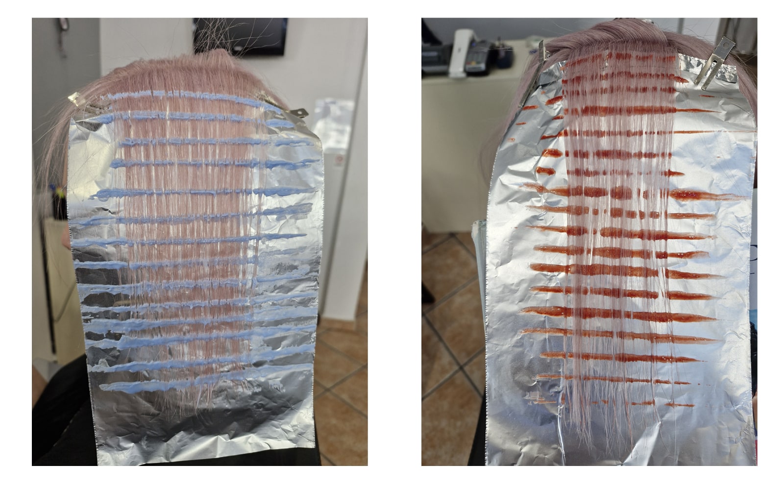 Shine Line technique
